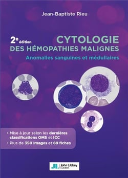 Cytologie des hémopathies malignes : Anomalies sanguines et médullaires (2e édition)