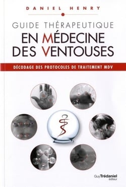 Guide thérapeutique en médecine des ventouses - décodage des protocoles de traitement MDV