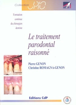 Le traitement parodontal raisonne