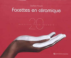 Facettes en céramique - 20 recettes pour réussir