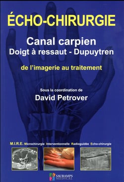 Écho-chirurgie - canal carpien, doigt à ressaut, Dupuytren
