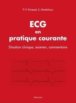 ECG en pratique courante - situation clinique, interprétation, décision