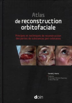 Atlas de reconstruction orbitofaciale - principes et techniques de reconstruction des pertes de substances péri-orbitaires