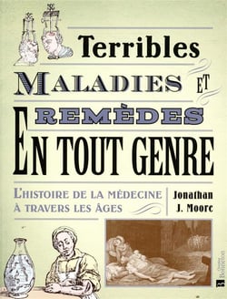 Terribles maladies et remèdes en tout genre : l'histoire de la médecine à travers les âges
