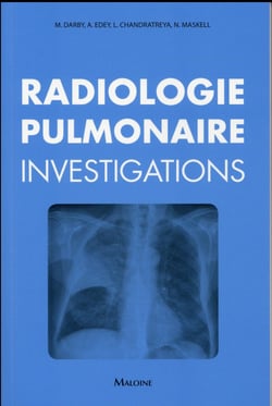 Radiologie pulmonaire : investigations
