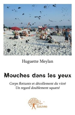 Mouches dans les yeux - corps flottants et décollement du vitré, un regard doublement squatté