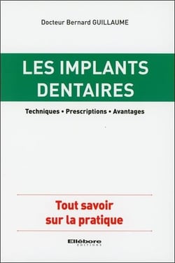 Les implants dentaires - techniques, prescriptions, avantages