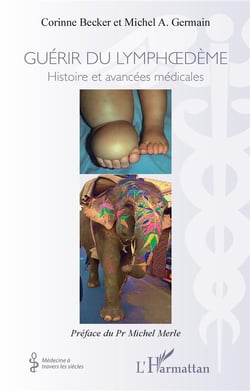 Guérir du lymphoedème : histoires et avancées médicales