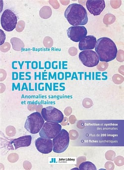 Cytologie des hémopathies malignes - anomalies sanguines et médullaires
