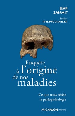 Enquête à l'origine de nos maladies : Ce que nous révèle la paléopathologie