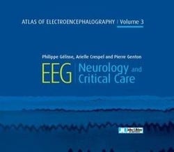 Atlas of electroencephalography v.3 - EEG, Neurology and critical care