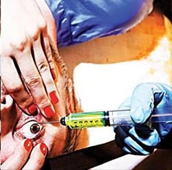 Acid or blood