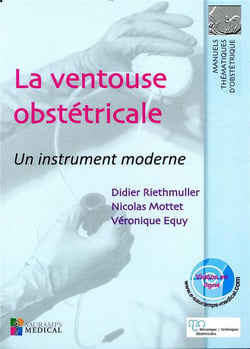 La ventouse obstétricale - un instrument moderne
