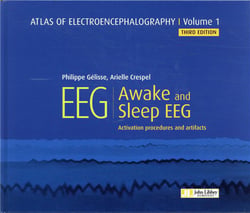 Atlas of electroencephalography v.1 - awake and sleep EEG (3e édition)