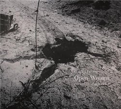 Open wound chechnya 1994-2001
