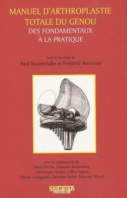 Manuel d'arthroplastie totale du genou - des fondamentaux à la pratique