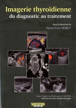 Imagerie thyroïdienne - du diagnostic au traitement
