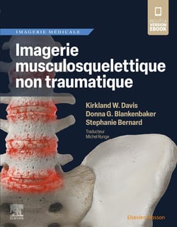 Imagerie musculosquelettique non traumatique