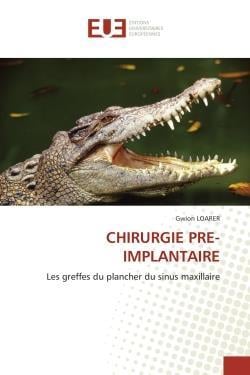 Chirurgie pre-implantaire - les greffes du plancher du sinus maxillaire
