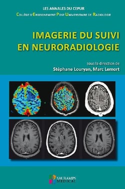 Imagerie du suivi en neuroradiologie