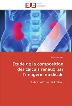 Etude de la composition des calculs renaux par l'imagerie medicale