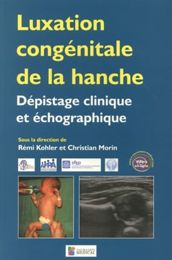 Luxation congénitale de la hanche - dépistage clinique et échographique