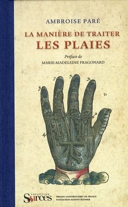 La manière de traiter les plaies