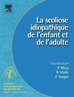 Scoliose idiopathique de l'enfant et de l'adulte