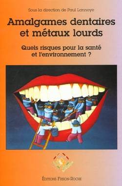 Amalgames dentaires