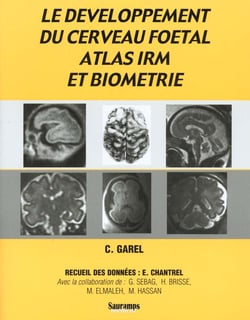 Le développement du cerveau foetal, atlas IRM et biometrie