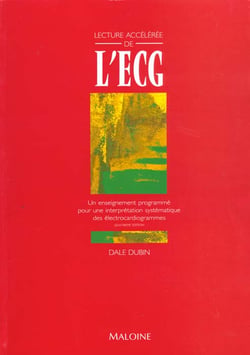 Lecture acceleree de l'ecg