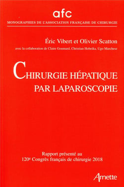 Chirurgie hépatique par Laparoscopie