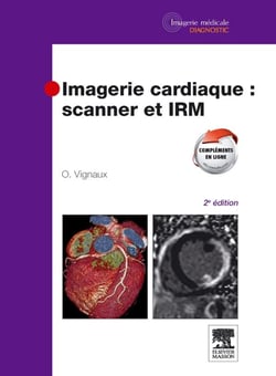 Imagerie cardiaque : scanner et IRM (2e édition)