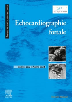 Échocardiographie foetale