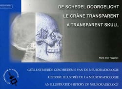 Le crâne transparent - histoire illustrée de la neuroradiologie
