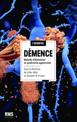 Démence : Maladie d'Alzheimer et syndromes apparentés