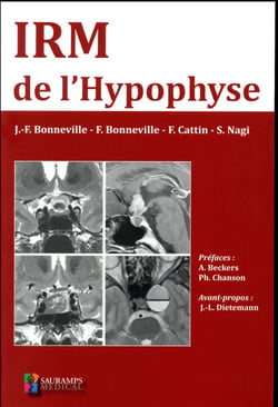 IRM de l'hypophyse