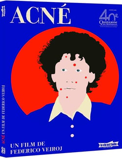 Acné