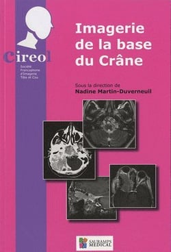 Imagerie de la base du crâne