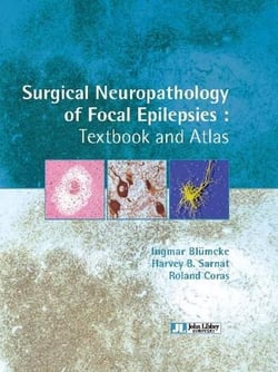 Surgical neuropathology of focal epilepsies - textbook and atlas