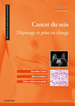 Cancer du sein - dépistage et prise en charge