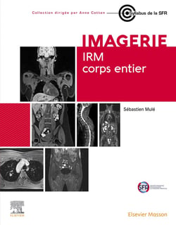 Imagerie : IRM corps entier