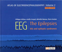 Atlas of electroencephalography v.2 - the epilepsies, EEG and epileptic syndromes (2e édition)