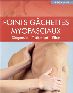 Points gachettes myofasciaux - diagnostic ? traitement ? effets