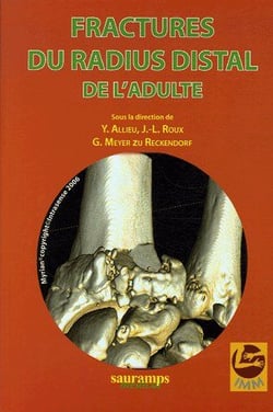 Fractures du radius distal de l'adulte