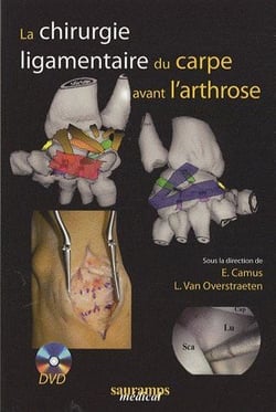 La chirurgie ligamentaire du carpe avant l'arthrose