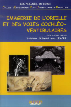 Imagerie de l'oreille et des voies cochléo-vestibulaires