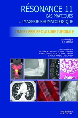 Résonance diagnostic en imagerie rhumatologique Tome 11 : Imagerie osseuse d'allure tumorale : Cas pratiques en imagerie musculosquelettique