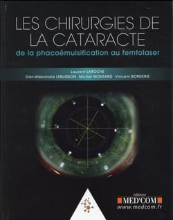 Les chirurgie de la cataracte. de la phacoemulsification au femtolaser