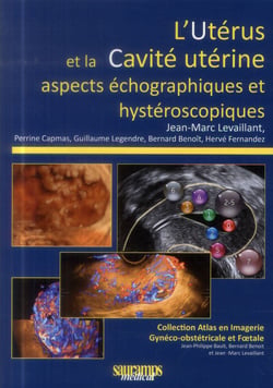 L'utérus et la cavité utérine - aspects échographiques et hystéroscopiques